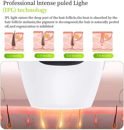 IPL Hair Removal System